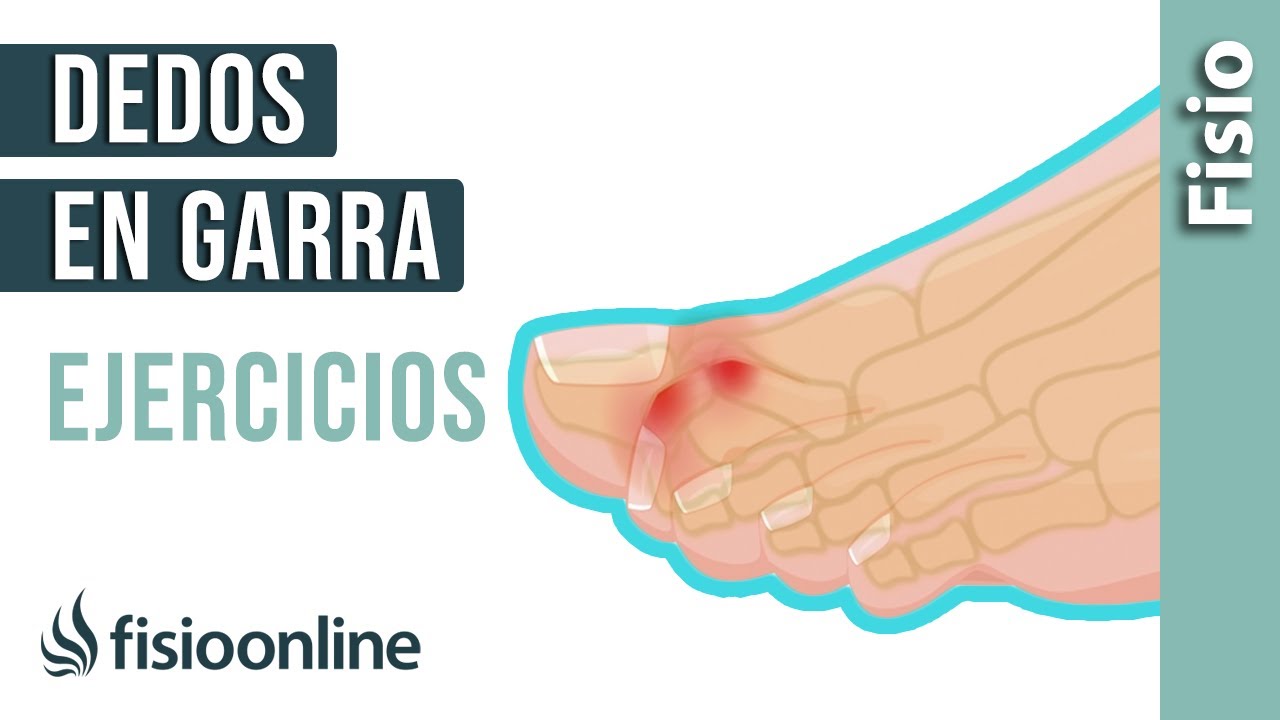 4️⃣EJERCICIOS para PREVENIR los DEDOS en GARRA