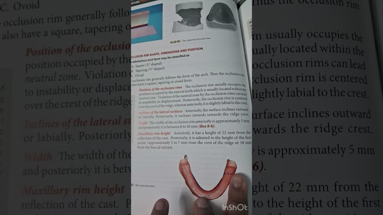 2 nd year bds with prosthodontics notes for exams in December 2023 #mangalore #mcods