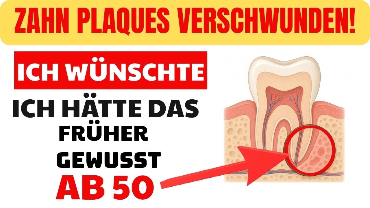 99% deines Zahn Plaques Loswerden - Zahn&auml;rzte hassen diesen einfachen Plaque-Trick - Nach 50