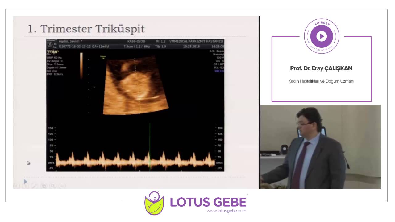 PROF. DR. ERAY ÇALIŞKAN - OBSTETRİDE DOPPLER KULLANIMI