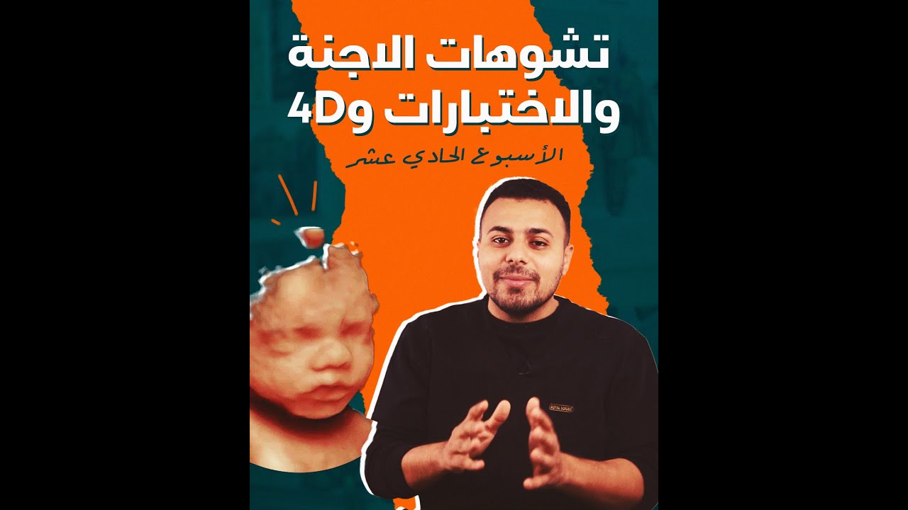 تشوهات الاجنة - نعرفها ازاي اثناء الحمل؟ - 11