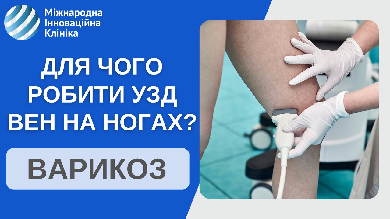 УЗИ вен нижних конечностей. Что самое важное в диагностике болезни вен на ногах?