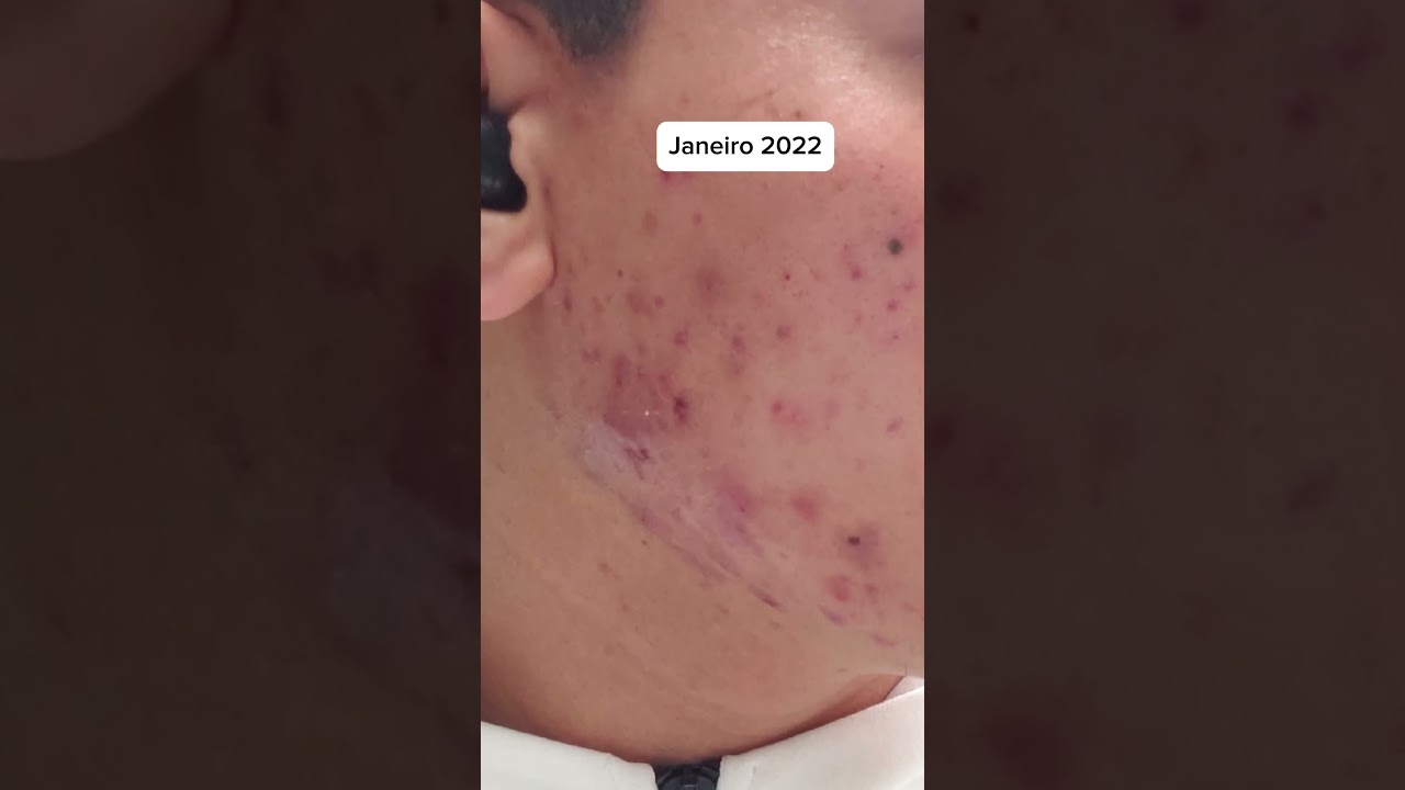 Morar na Coreia do Sul mudam Peles! #coreiadosul #dermatologista #skincare