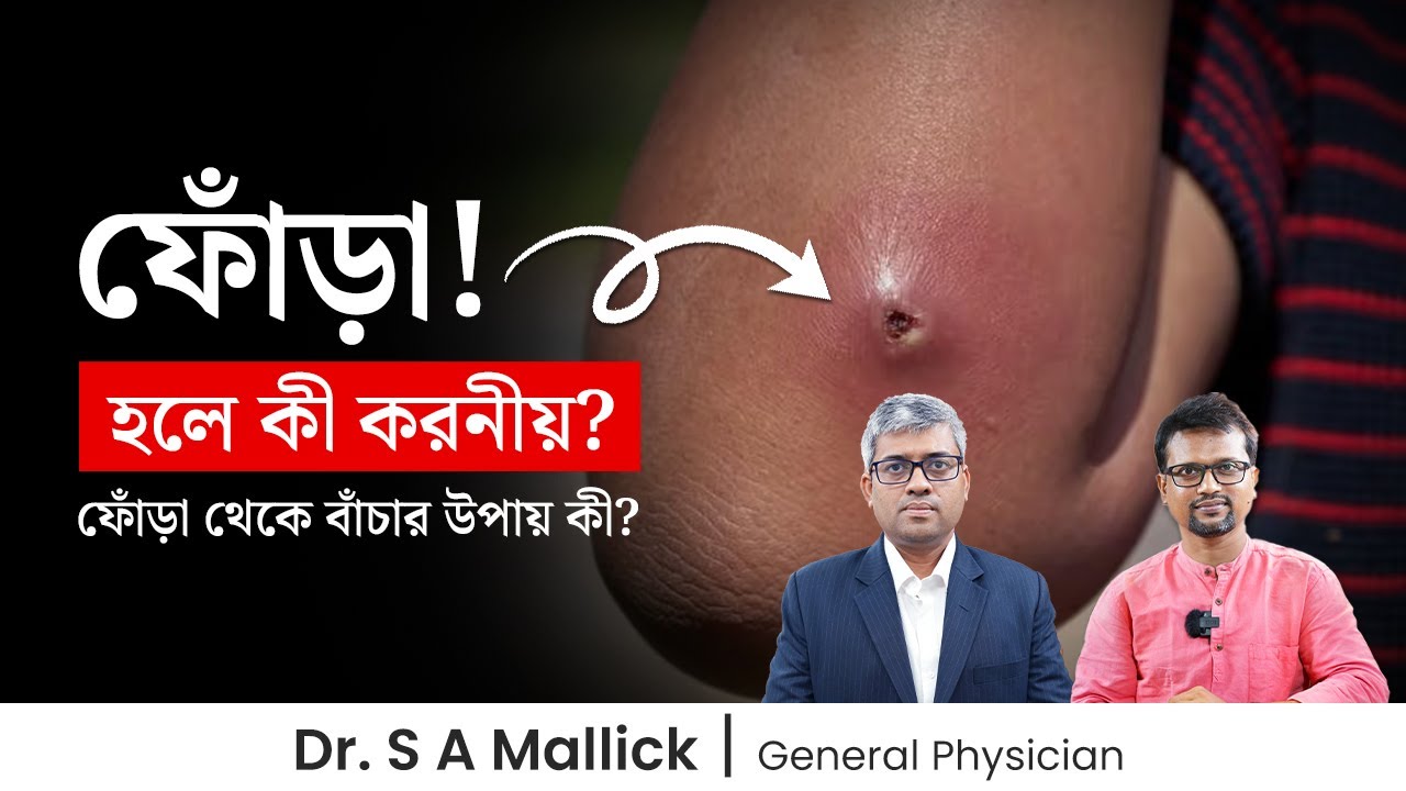 শরীরে ফোঁড়া হলে করনীয় কী? ফোঁড়ার ঘরোয়া চিকিৎসা | ফোঁড়া হলে কি করবেন না? ফোঁড়া প্রতিরোধের উপায়