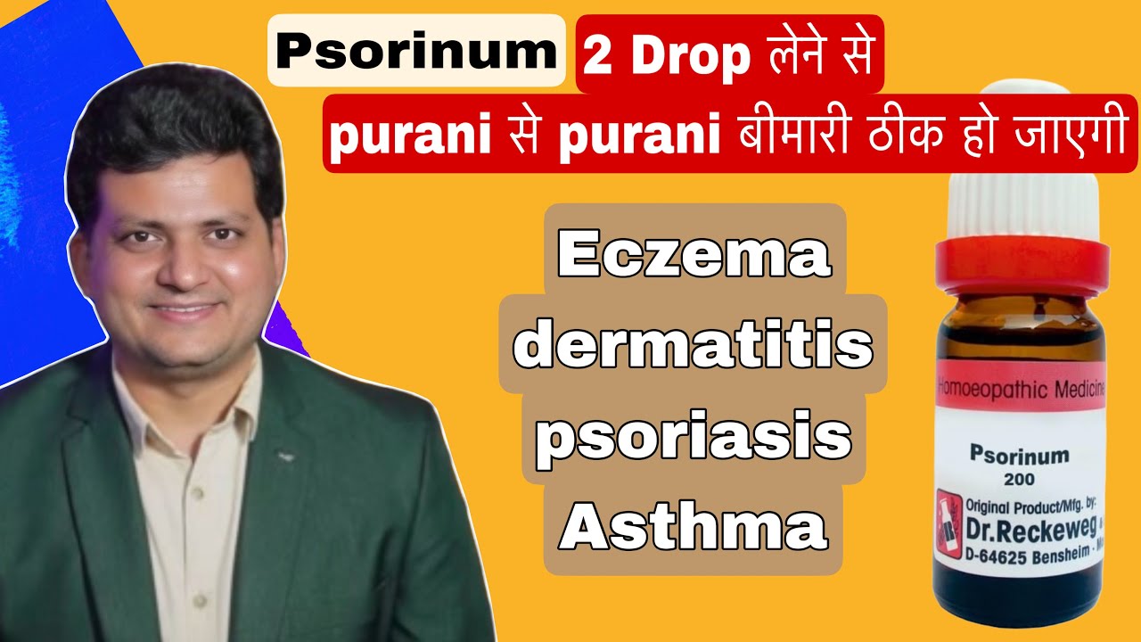 Psorinum Homeopathic Medicine | Symptoms | How to Use | Eczema & Asthma