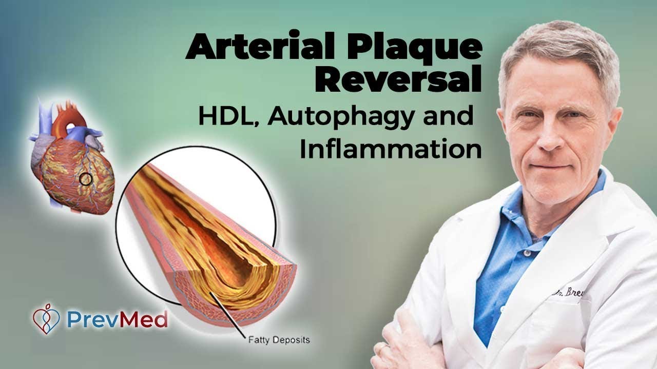 Arterial Plaque Reversal: HDL, Autophagy & Inflammation