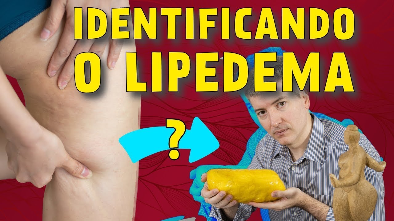 Como é Realizada a Identificação do Lipedema?