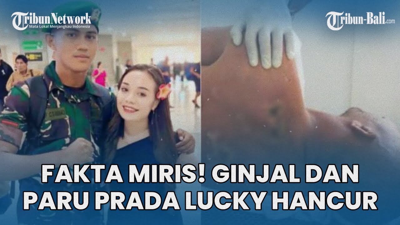FAKTA MIRIS! Ginjal dan Paru-paru Prada Lucky Hancur Akibat Penganiayaan 20 Anggota TNI di NTT