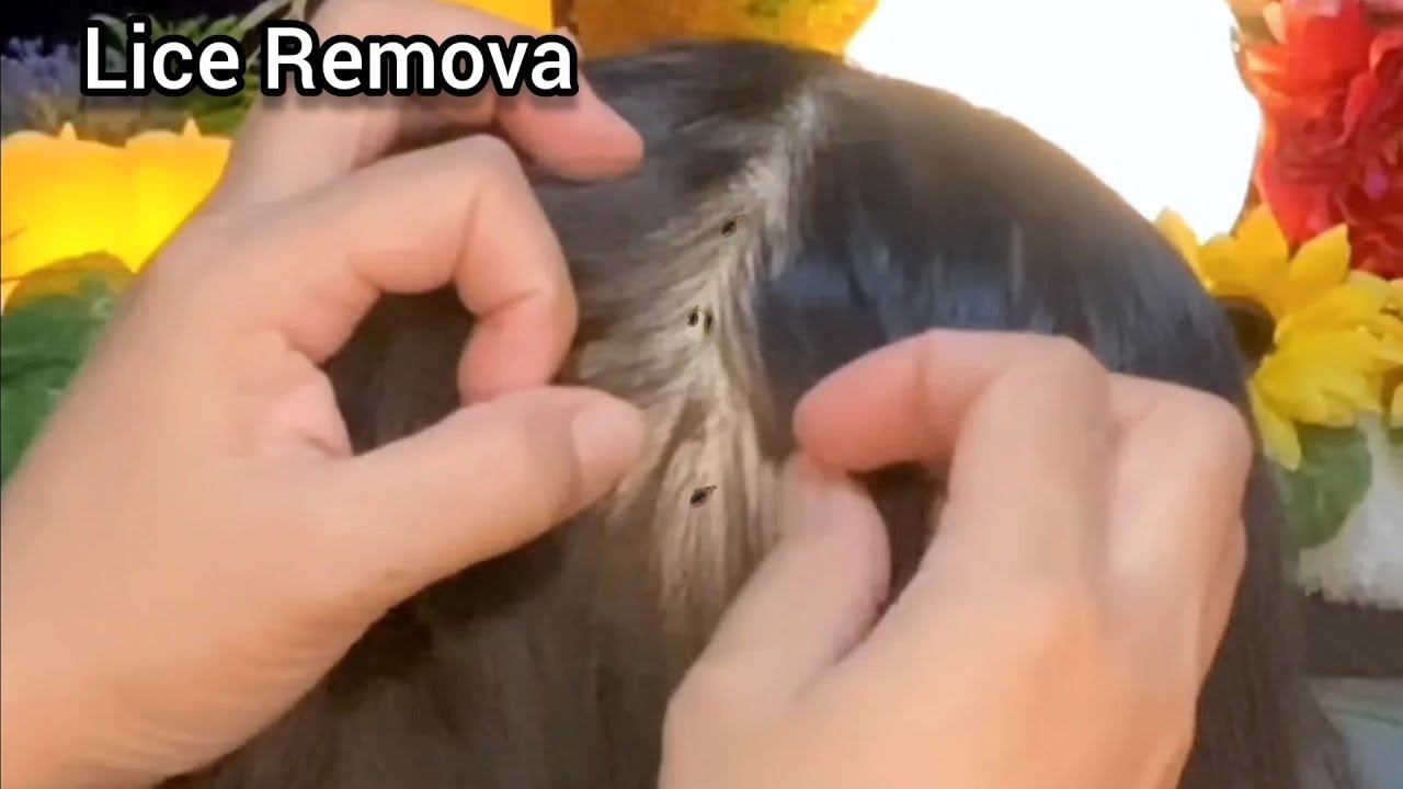 ASMR You have bad lice problem, Sis will help to remove it | No Talking 😴💤🥱