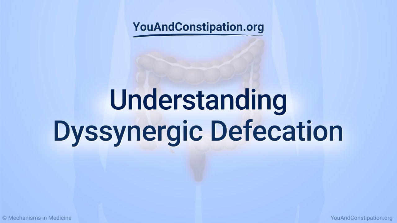 Understanding Dyssynergic Defecation