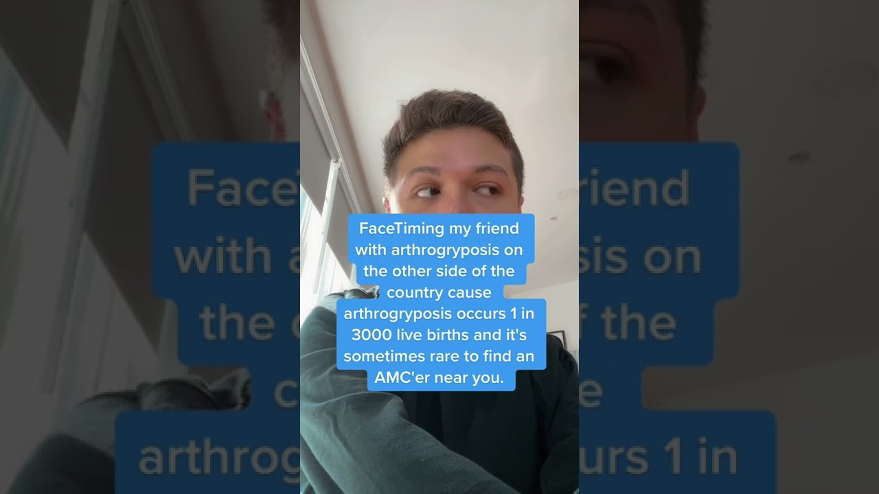 Arthrogryposis is Rare