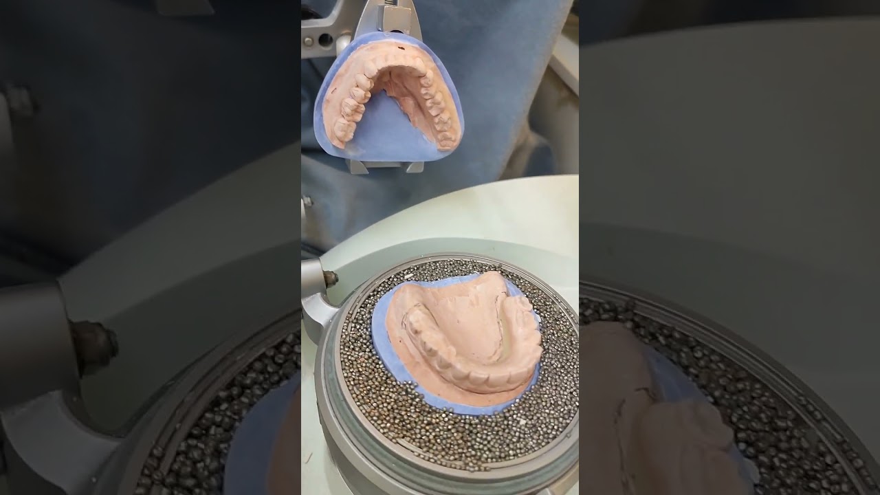 F&Eacute;RULA DE BRUXISMO #nuriadental #protesisdental #esteticadental #boca #protesisdentales