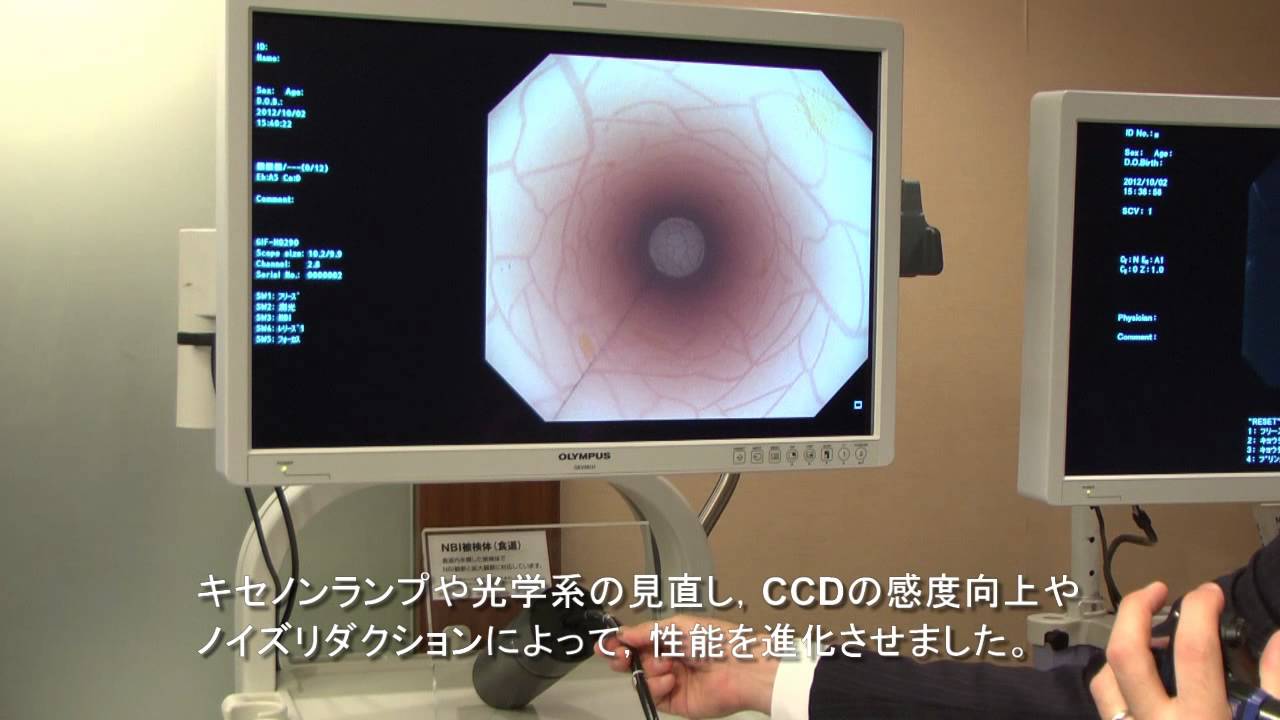 オリンパス新型内視鏡ビデオスコープシステム