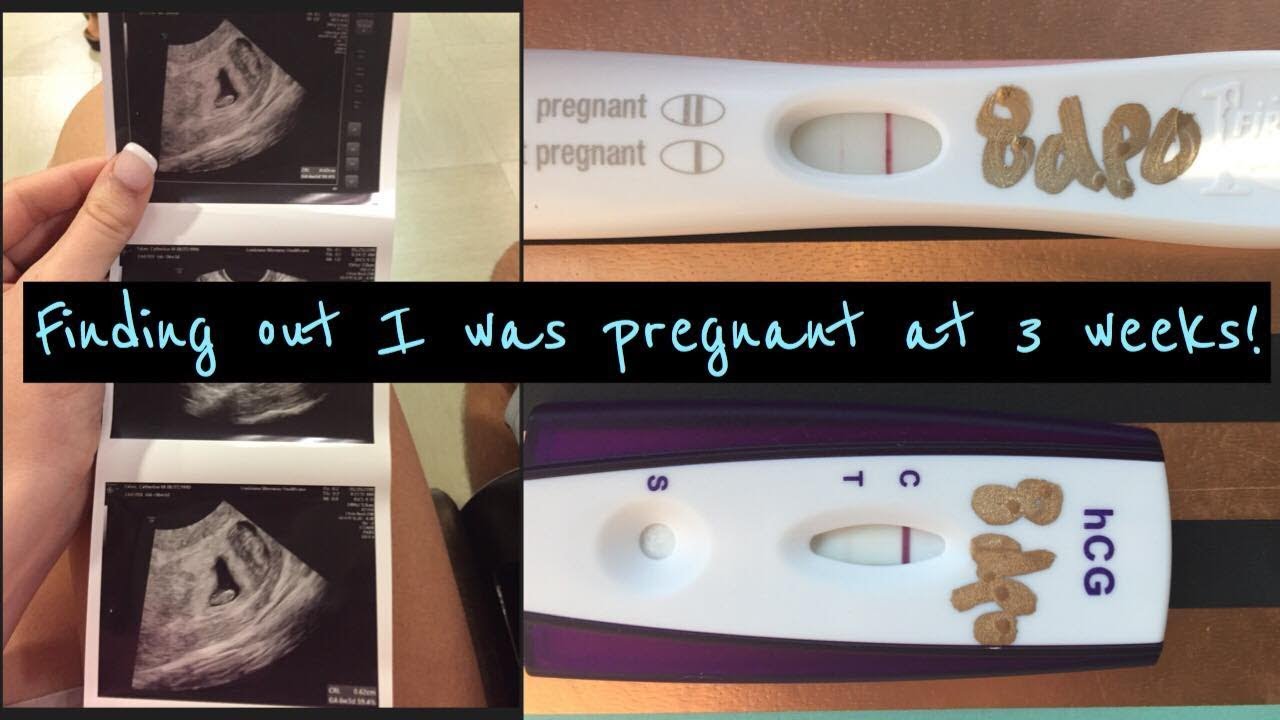 Finding out I was pregnant | at 3 weeks pregnant | Telling Family | pregnancy test line progression