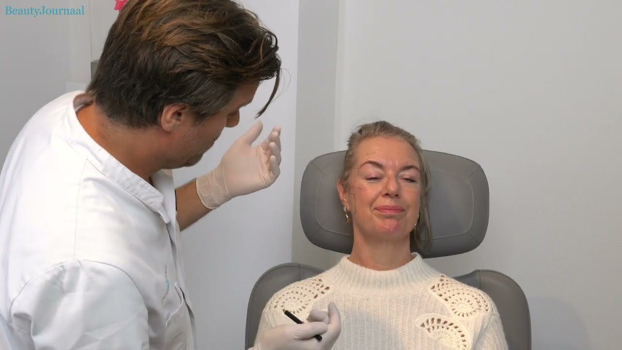 Jukbeen, kaaklijn en kin - Monique krijgt meer contour met fillers bij dokter Frodo