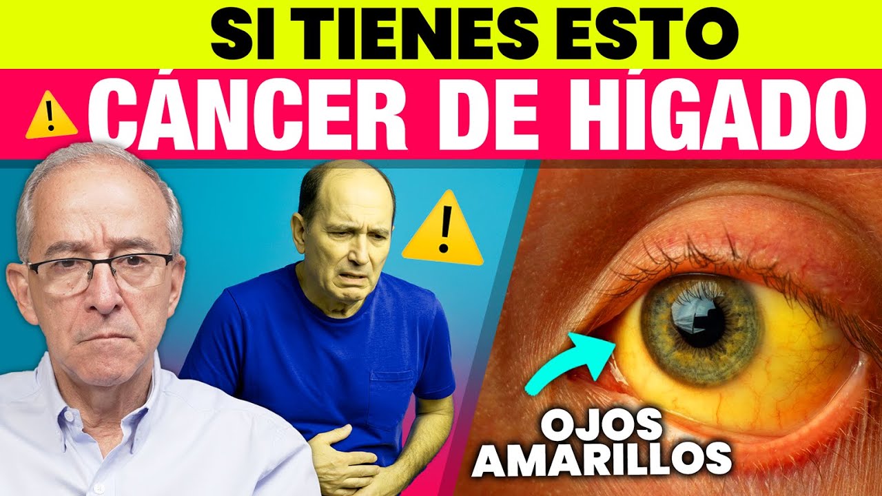 🧬 CANCER DE HIGADO Primeros Síntomas (Señales de Alerta) - Oswaldo Restrepo RSC