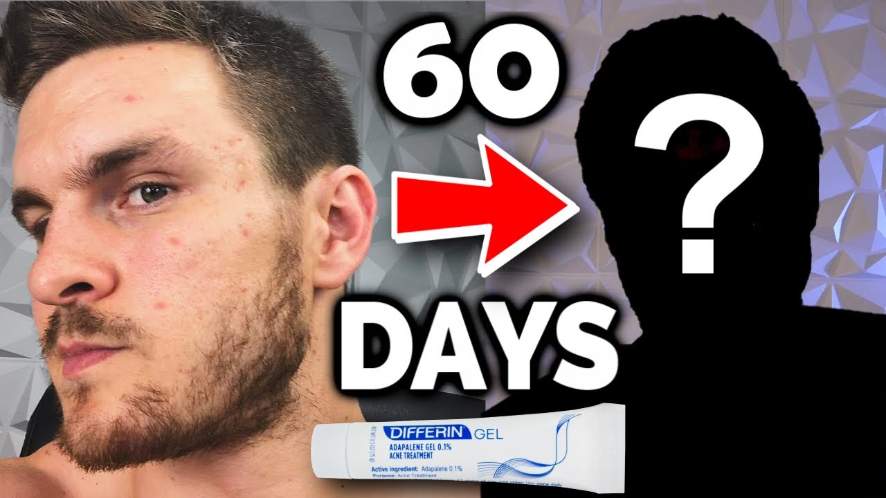 Я принимал Дифферин в течение 60 дней, и вот что произошло!
