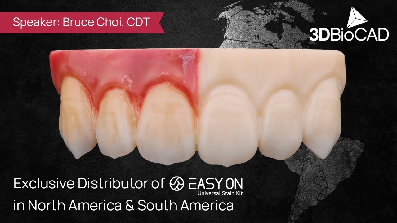 Aesthetics on Full Zirconia Cases with Easy On Stain Kits by Bruce Choi, CDT