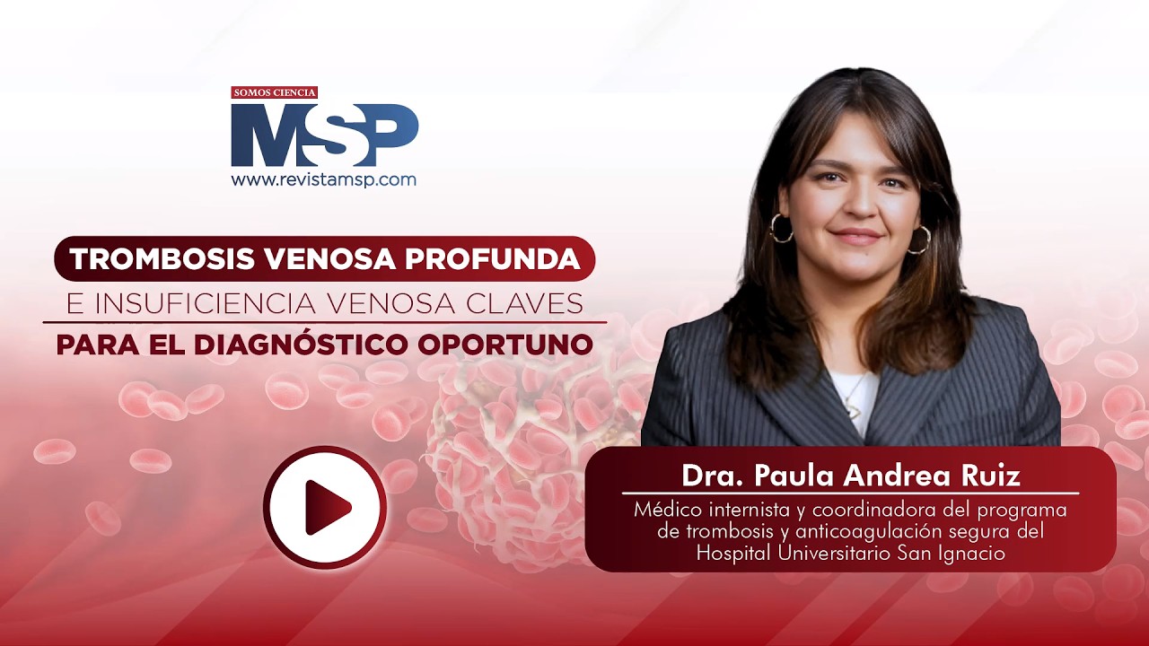 Trombosis venosa profunda e insuficiencia venosa: Claves para el diagnóstico oportuno