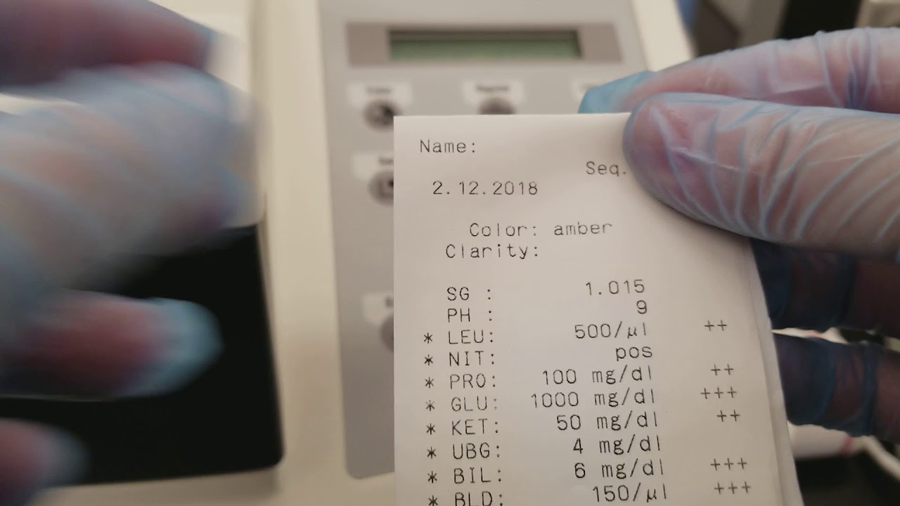 Urinalysis: Replacing the printer paper on the Criterion II and QC troubleshooting