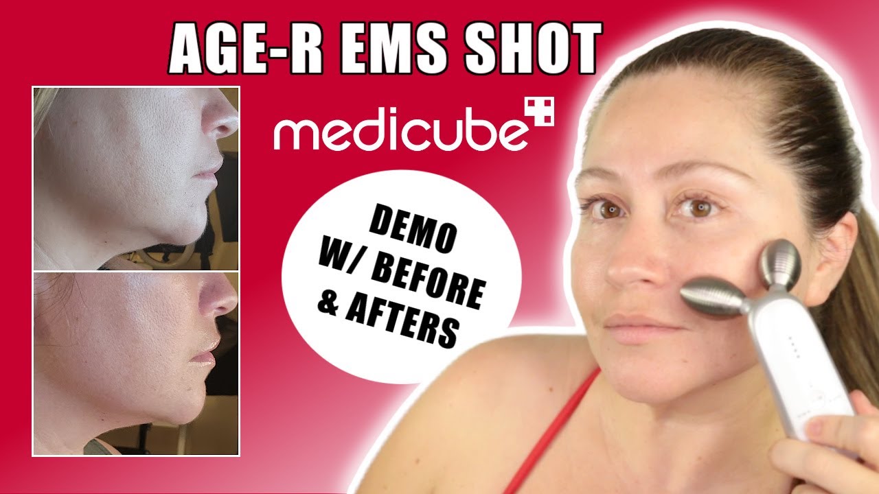 MEDICUBE AGE-R EMS DERMA SHOT DEVICE| 2 MONTHS RESULTS| DEMO AND LOTS OF BEFORE & AFTERS