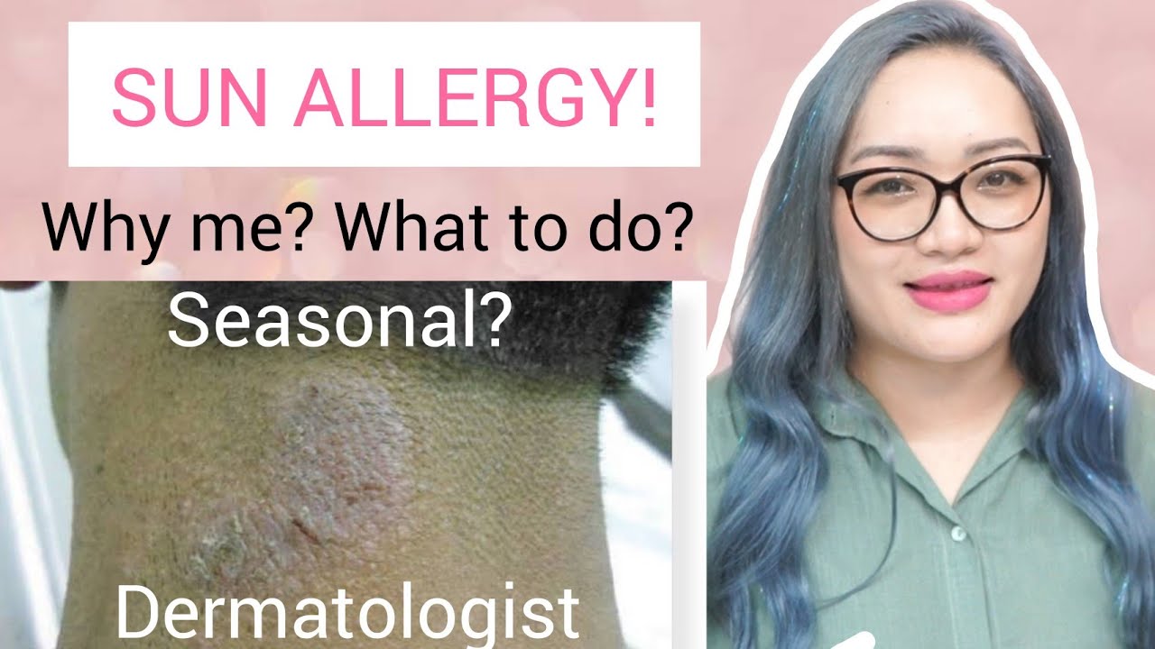 NI ZUNG ALLERGY RINGWORM A NI LO| Dr. Nancy Lalnunpuii