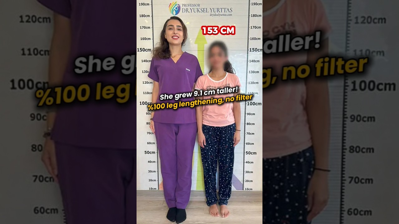 154 cm to 163 cm | +9.1 cm Taller - Leg Lengthening Surgery Result 
