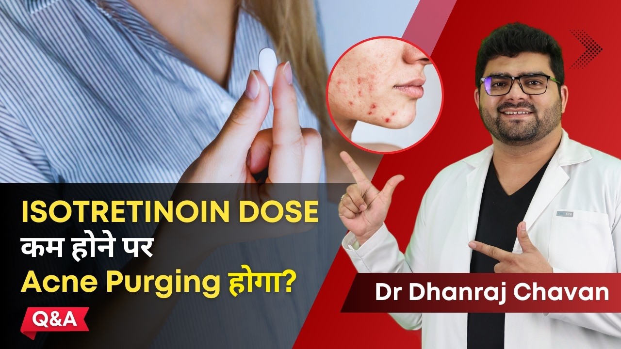 क्या Isotretinoin Dose कम होने पर  Acne Purging होगा? | Isotretinoin & Purging | Clear Skin, Pune