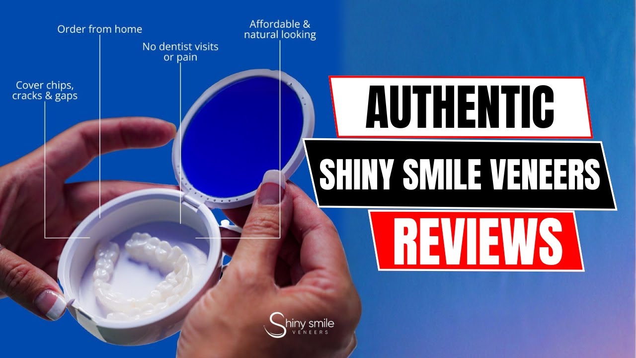 Отзыв о винирах Shiny Smile – окончательный вердикт после ношения!