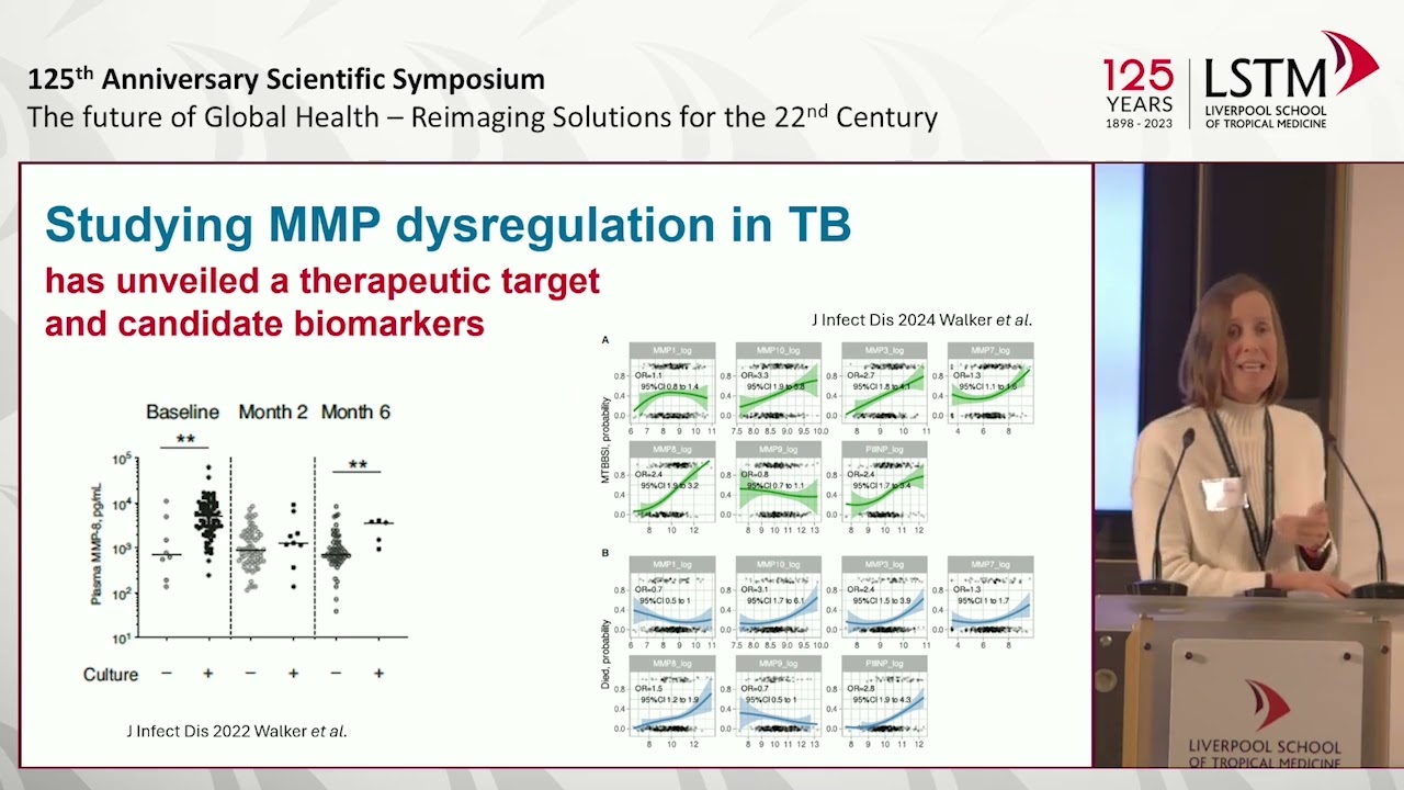 Can we end TB by 2030?