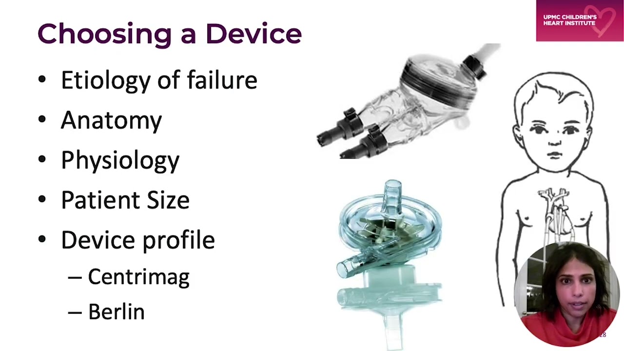 Mechanical Support in Early Stages of Univentricular Heart Palliation -  Melita Viegas, MD