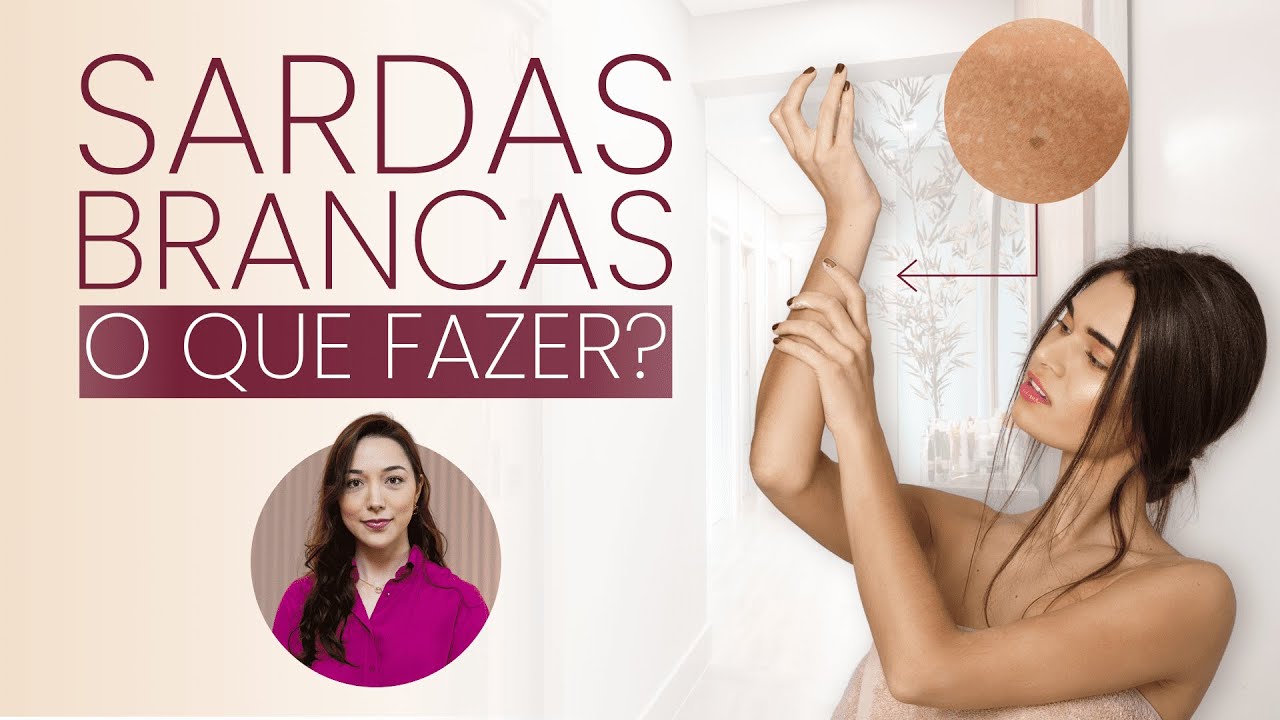 SARDAS BRANCAS | O que é? Como tratar?