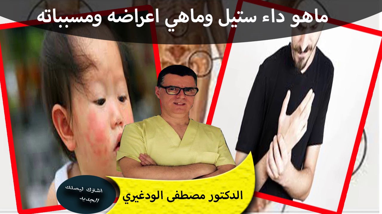ماهو داء ستيل وماهي اعراضه وخطورته وماهي اسبابه وطرق العلاج منه الدكتور مصطفى الودغيري