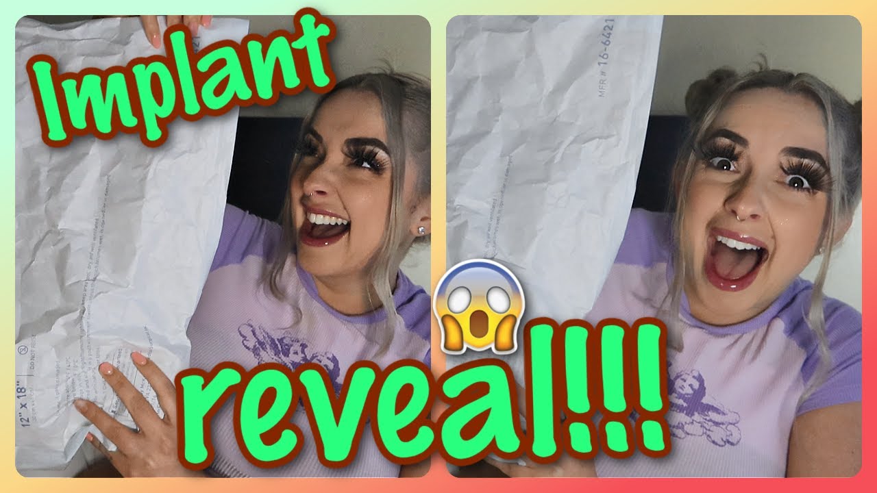 Reacting to my OLD IMPLANTS + REVEAL *I GOT THEM BACK*