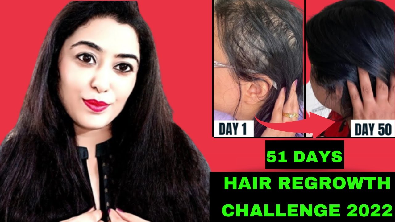 My subscriber applied my remedy for 51 days and got her hair back #extremehairregrowth #longhair