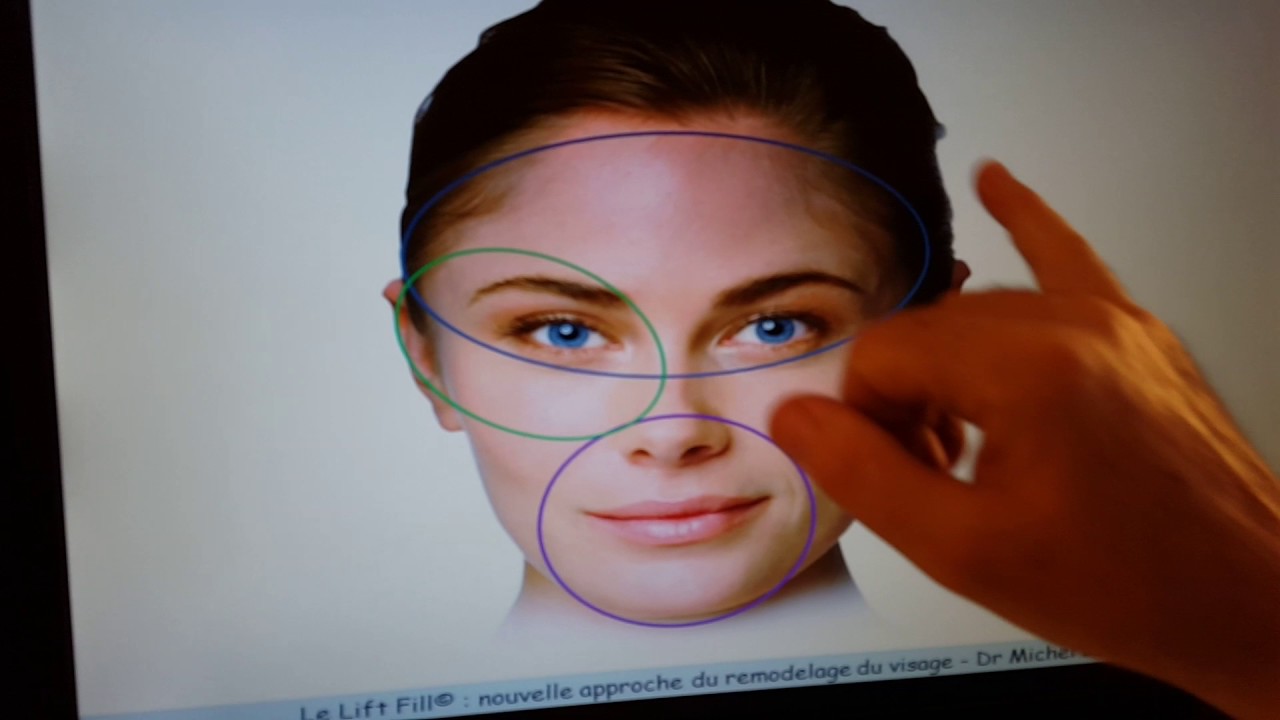 Remodelage visage