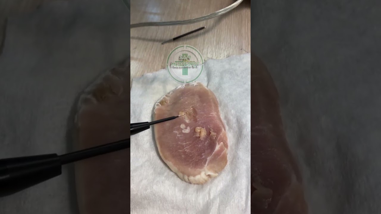 ITC-250D в работе: обзор возможностей ЭХВЧ