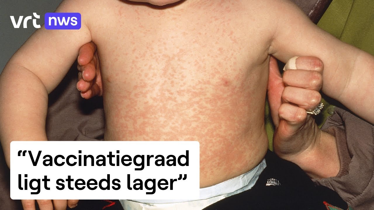 Mazelen in opmars in Antwerpen