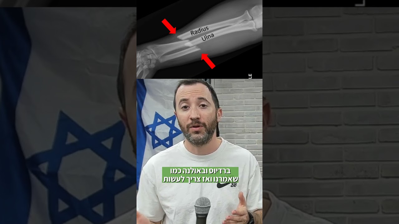 שבר קשה ביד ללוחם mma