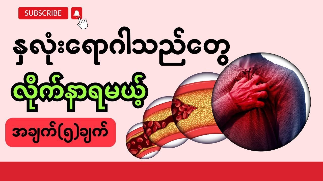 နှလုံးရောဂါသည်တွေလိုက်နာရမယ့်အချက်(၅)ချက်