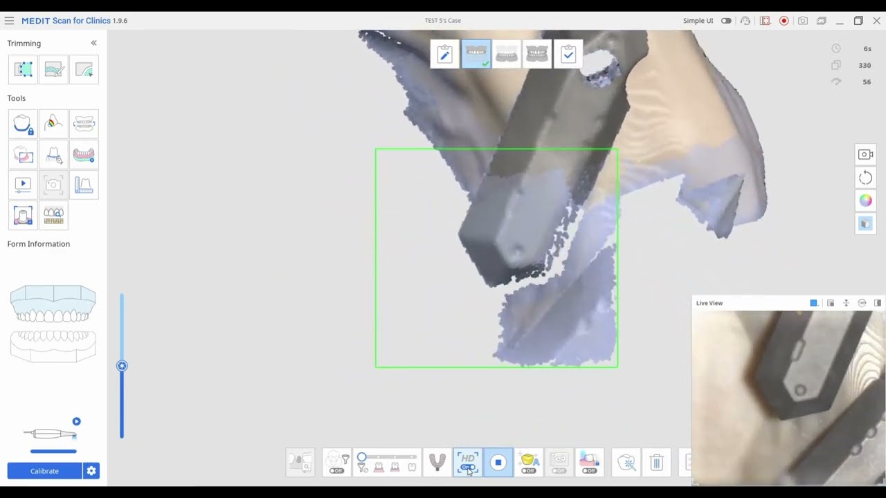 MEDIT - Performing Scan Gauges Scans & Exporting