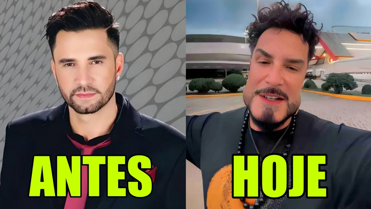 6 FAMOSOS que FICARAM IRRECONHECÍVEIS APÓS CIRURGIAS PLÁSTICAS e HARMONIZAÇÃO
