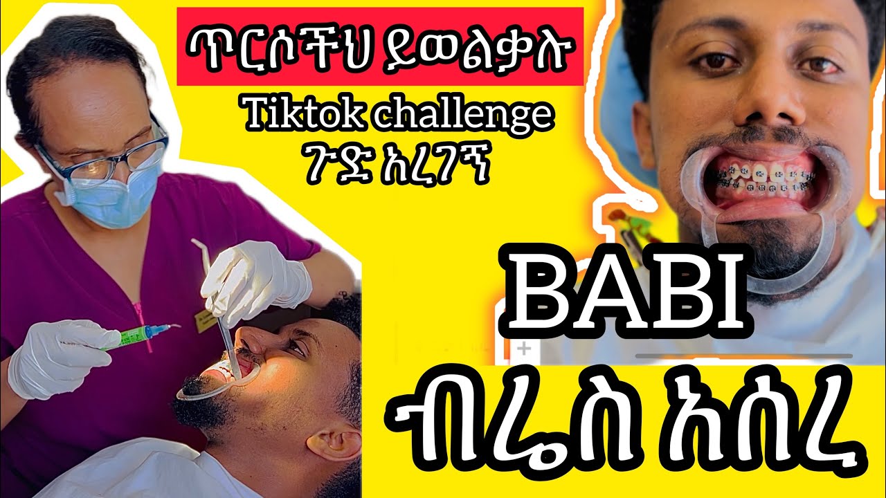 ባቢ ብሬስ አሰረ || Babi and Grace New video 2023