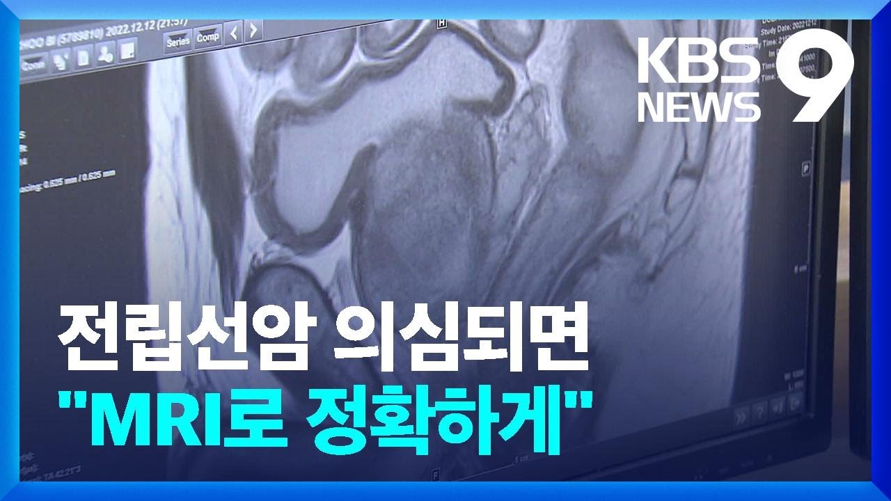 &lsquo;번번이 허탕&rsquo; 전립선암 생검&hellip;&ldquo;진단율 높인다&rdquo; [9시 뉴스] / KBS  2022.12.25.