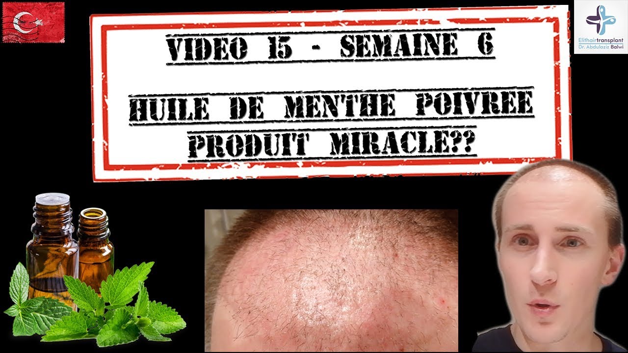 Menthe Poivrée, produit miracle?? 