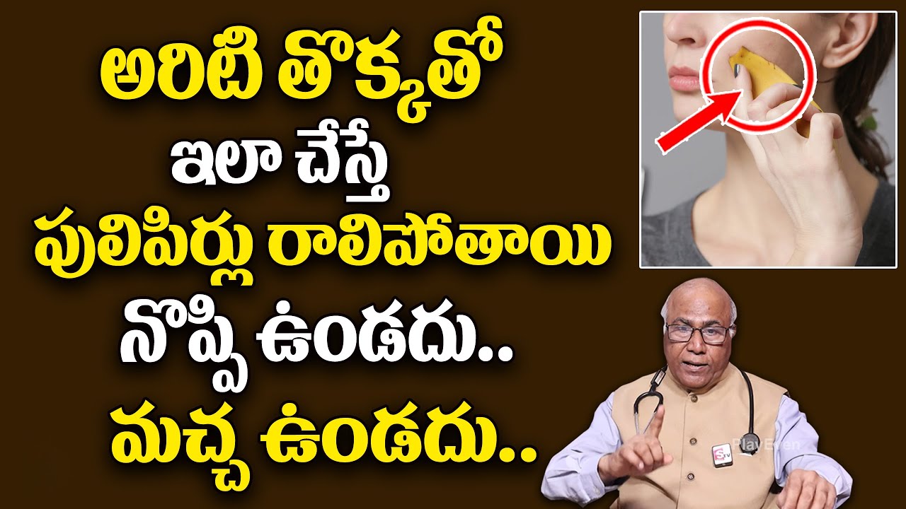 అరిటితో ఇలా చేస్తే పులిపిర్లు రాలిపోతాయి | A Solution to Remove Warts | Dr CL Venkat Rao | PlayEven