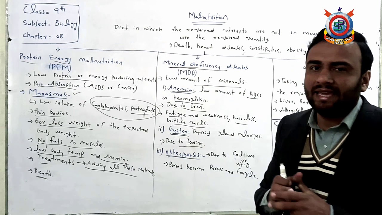 Biology Lecture 35 Topiic; Malnutrition Class 9th