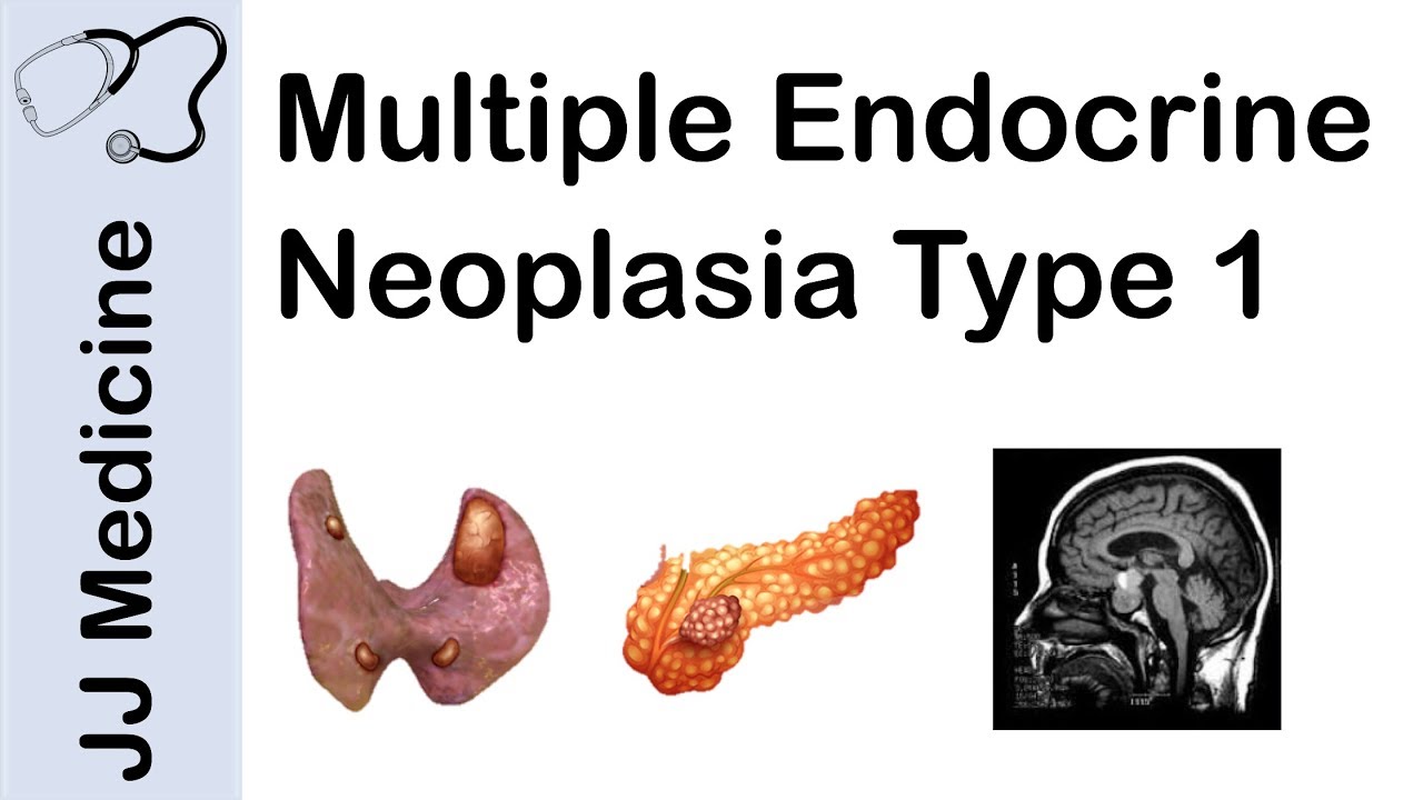 Multiple Endocrine Neoplasia Type 1 (MEN-1) | Signs and Symptoms, Diagnosis and Treatment
