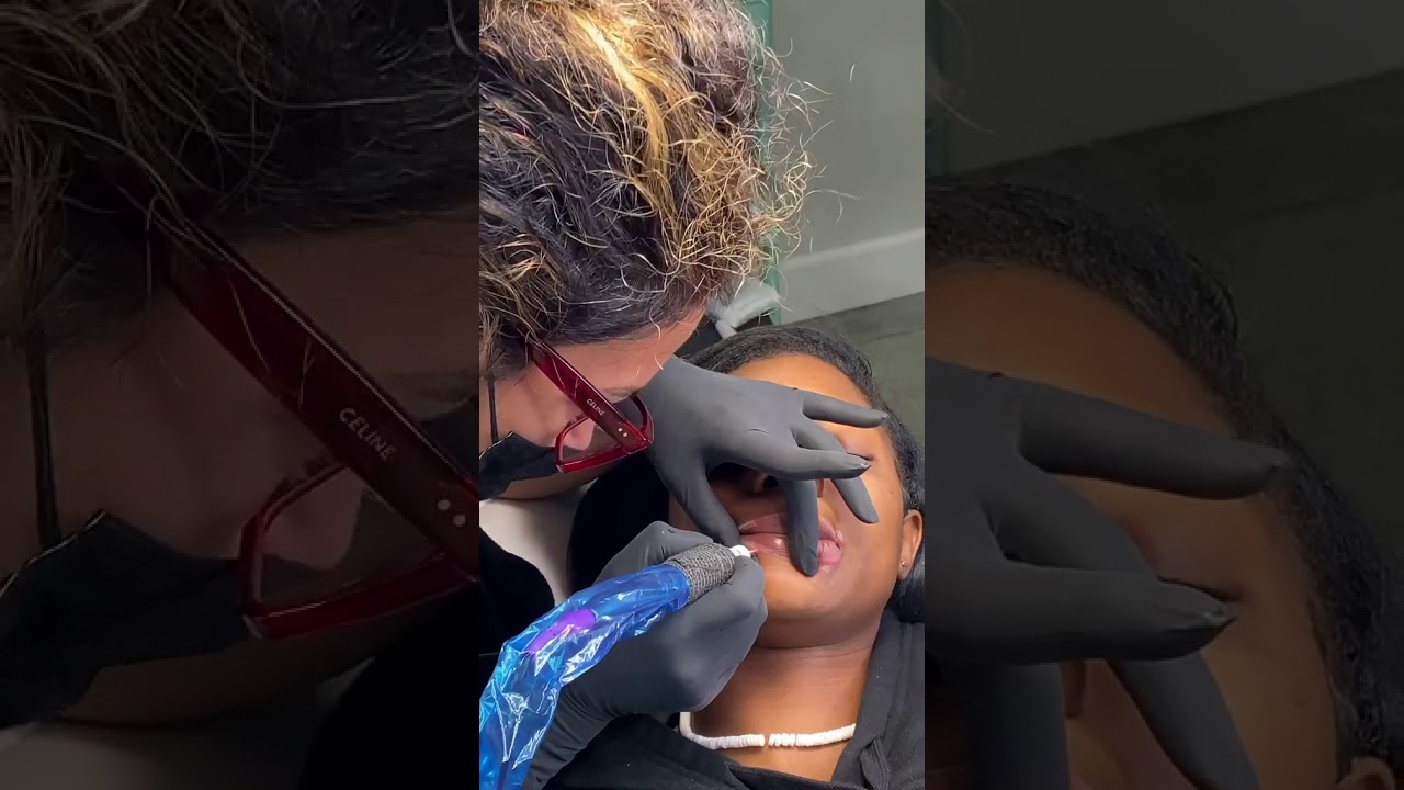 Dark Lip Correction with Carla Ricciardone
