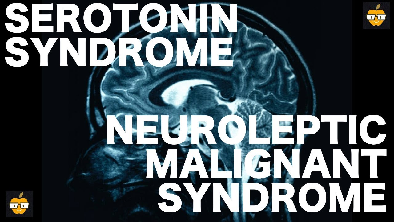 Serotonin Syndrome vs. Neuroleptic Malignant Syndrome
